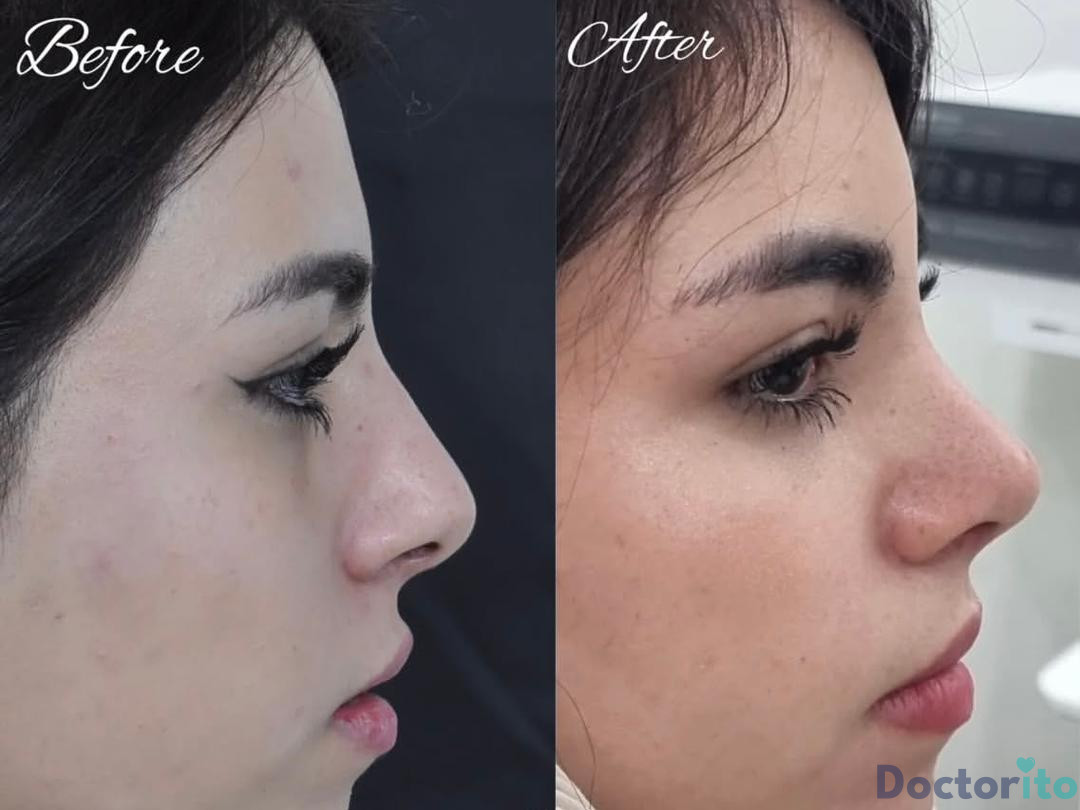 نمونه کار دکتر لیلا شریفی (2)