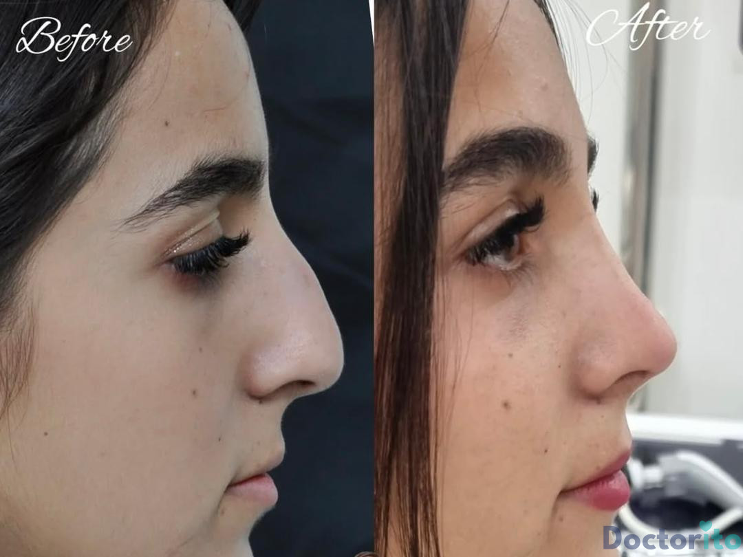 نمونه کار دکتر لیلا شریفی (3)