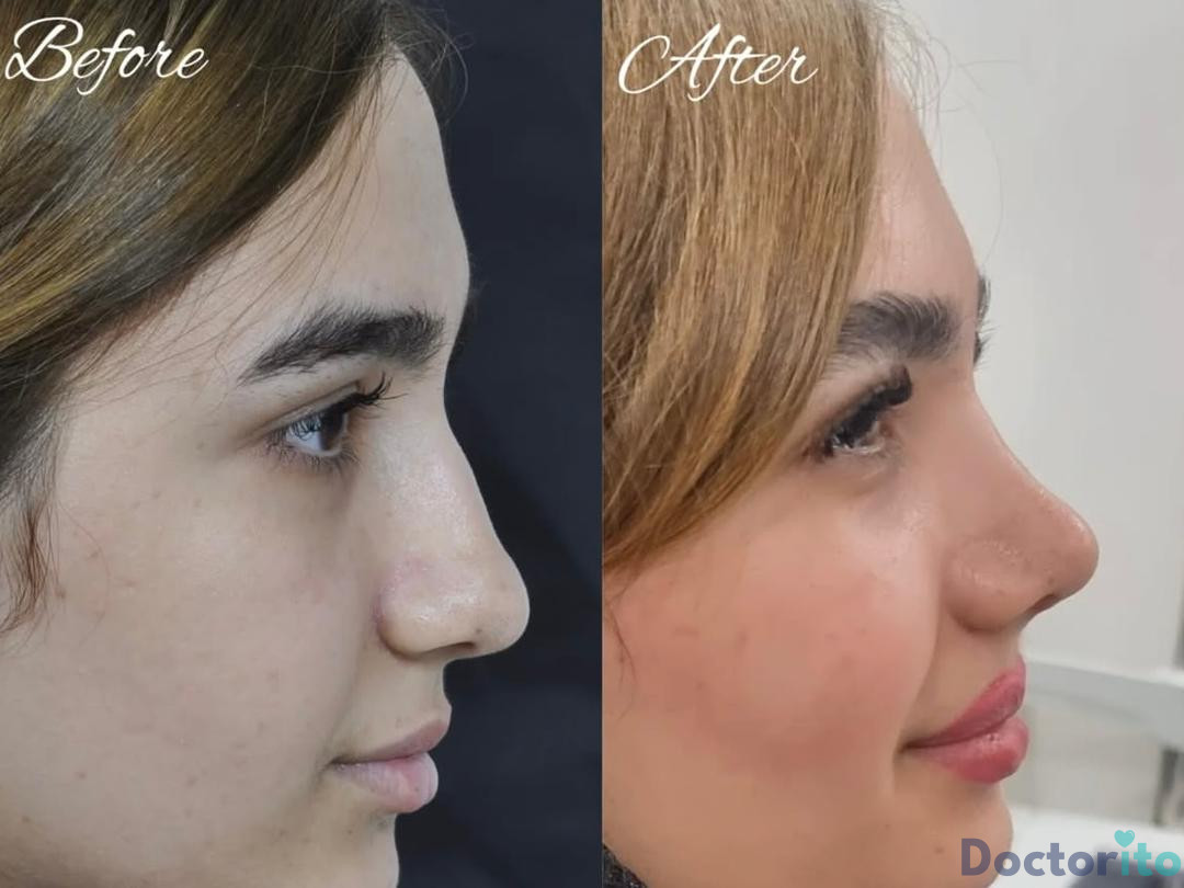 نمونه کار دکتر لیلا شریفی (4)