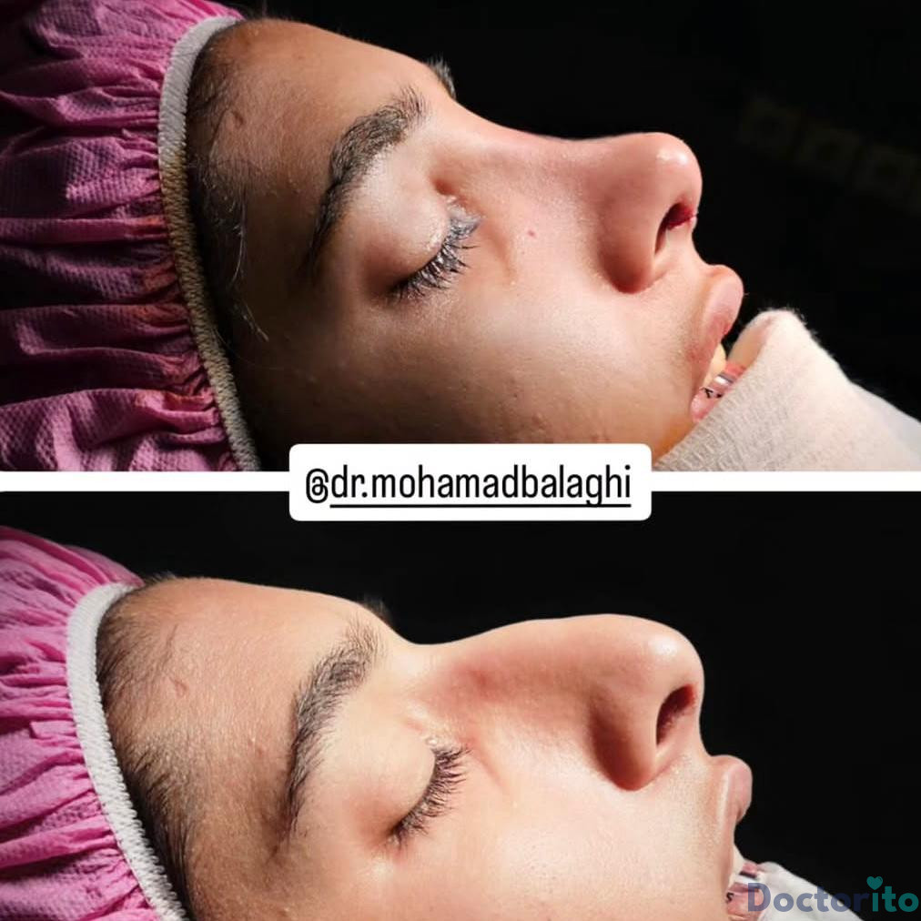 نمونه کار دکتر محمد بلاغی (2)