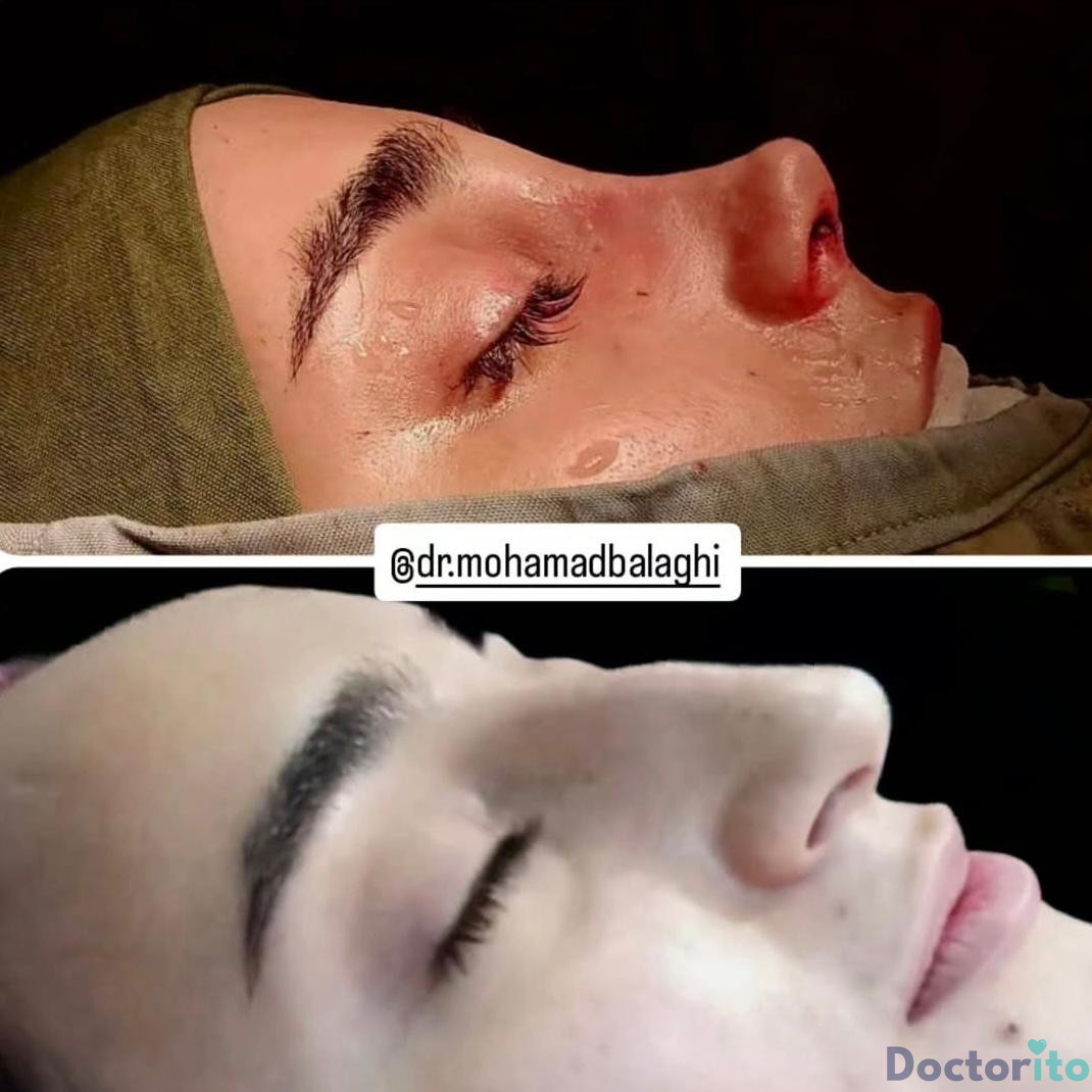 نمونه کار دکتر محمد بلاغی (4)