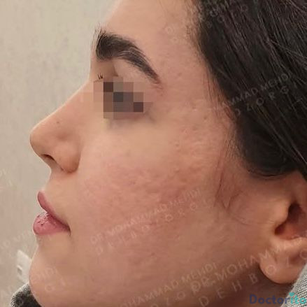 نمونه کار دکتر محمد مهدی ده بزرگی(2)