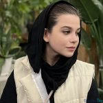 نمونه عمل بینی دکتر فرزاد نیکو سرشت3
