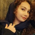 نمونه عمل بینی دکتر فرزاد نیکو سرشت1