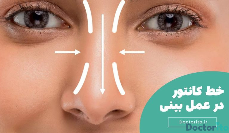 خط کانتور در عمل بینی