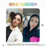نمونه عمل بینی سید محمد طالب زاده7
