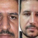 نمونه عمل بینی دکتر شاهین کریمیان2