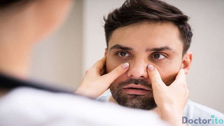 عمل بینی کلیپسی یا منگنه ای