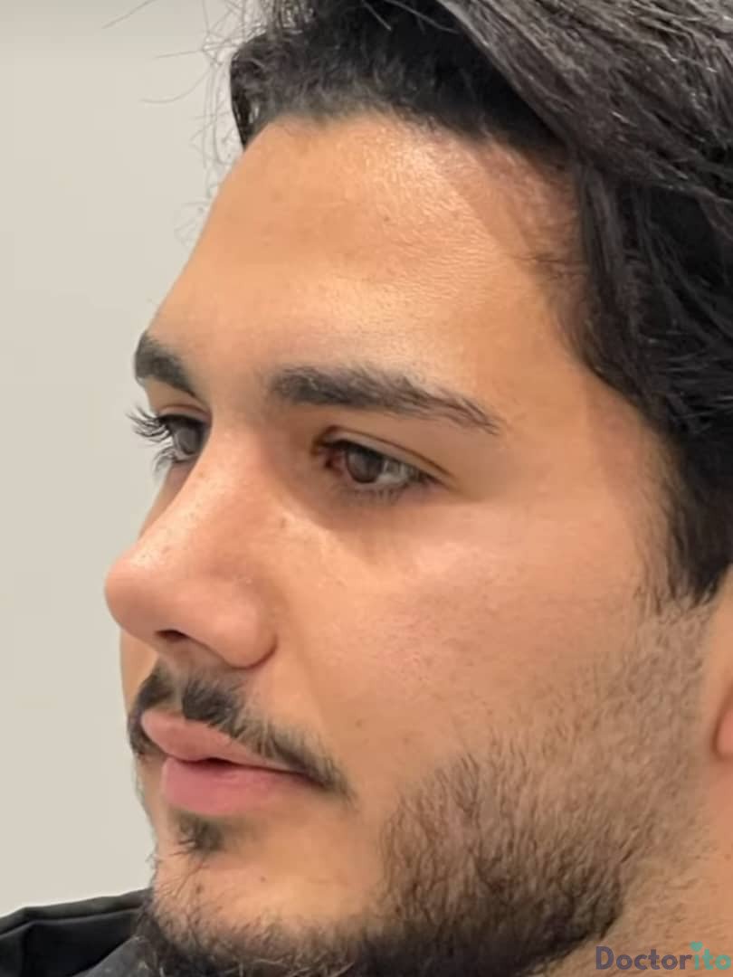 نمونه عمل بینی دکتر سید محمد طالب زاده (1)