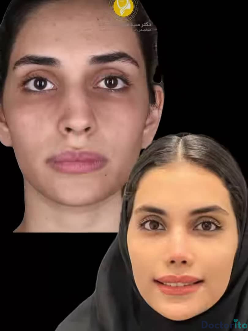 نمونه عمل بینی دکتر سید محمد طالب زاده (5)