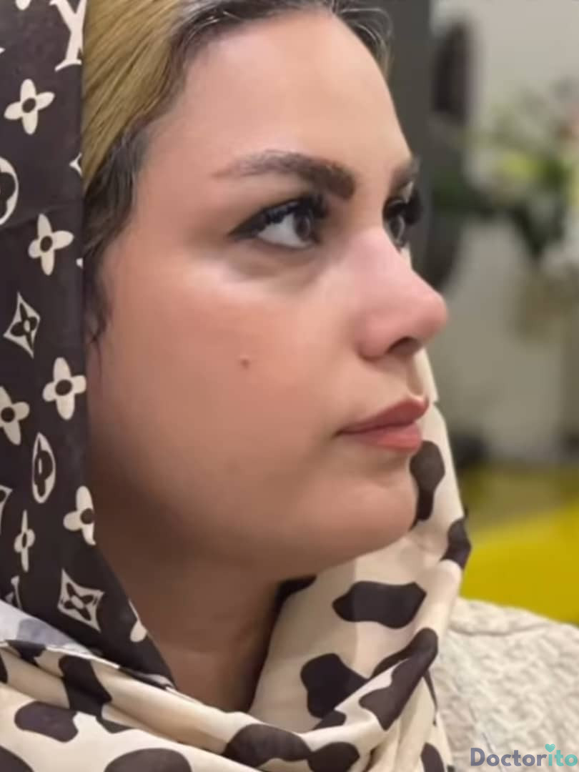 نمونه عمل بینی دکتر سید محمد طالب زاده (8)