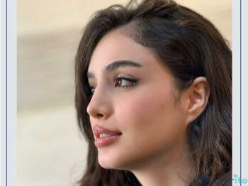 نمونه عمل بینی دکتر محسن بهادر (2)