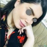 نمونه عمل بینی دکتر مسلم واحدی پور (1)