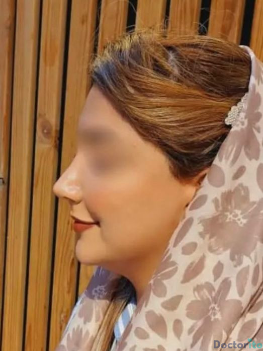 نمونه کار دکتر آرش سبحان منش (2)