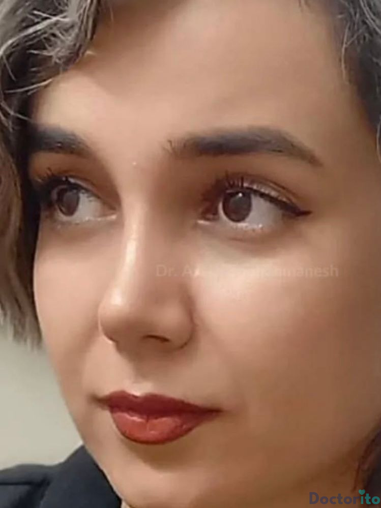 نمونه کار دکتر آرش سبحان منش (3)