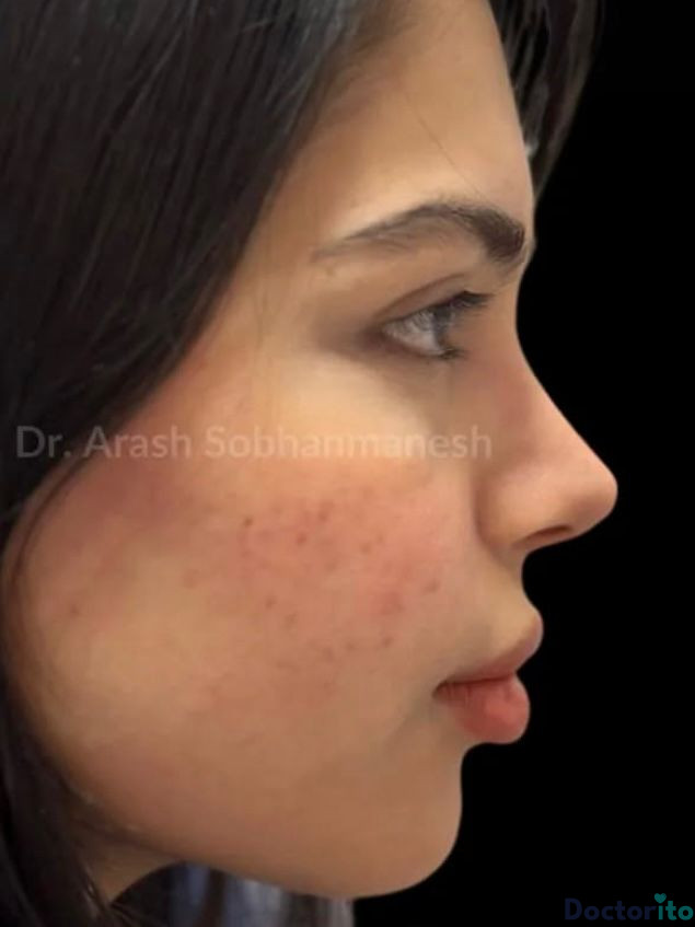 نمونه کار دکتر آرش سبحان منش (4)